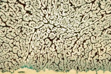 MATTEO-STELLA-Radeche-Fonne