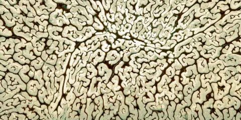 MATTEO-STELLA-Radeche-Fonne